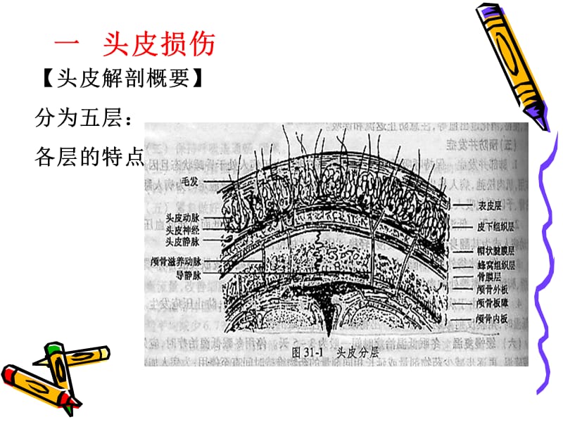 颅脑损伤病人的护理1.ppt_第3页