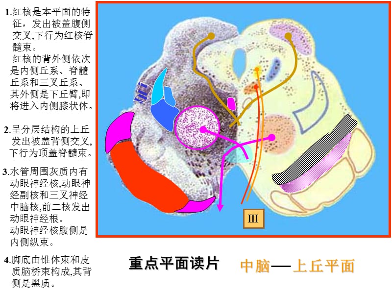 脑干网状结构小脑---《解剖学》.ppt_第3页