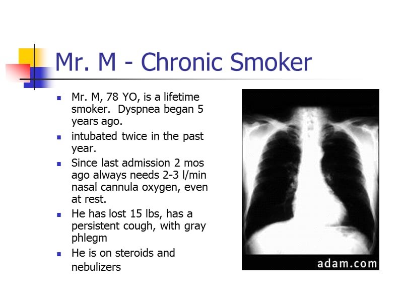 肺和胃肠道症状：在生命的尽头的普通物理症状.ppt_第2页