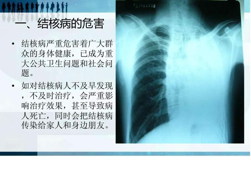 色达县结核病知识讲座.ppt.ppt_第2页