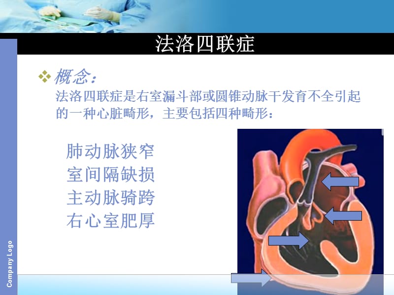 tof法洛四联症 ppt课件.ppt_第2页