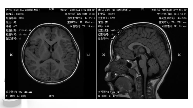 mri简介针对实习生ppt课件.ppt_第1页