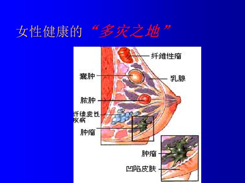 乳腺疾病的诊断与治疗（精）.ppt_第3页