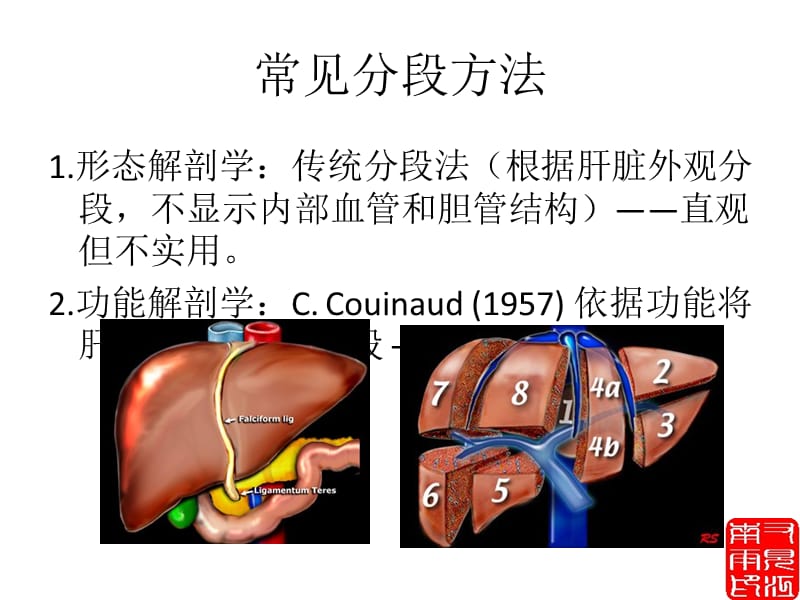 肝脏正常解剖及检查方法ppt课件.ppt_第2页