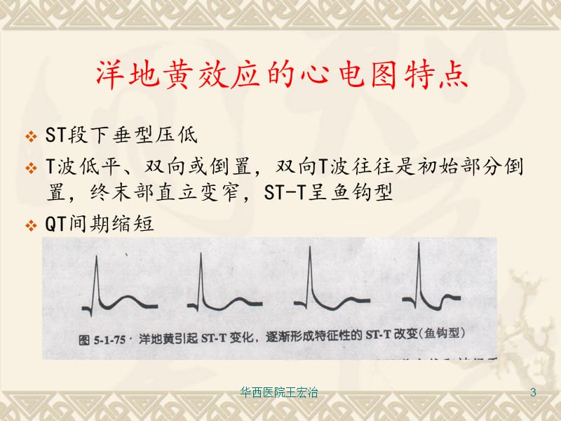 药物影响和电解质紊乱ppt课件.ppt_第3页