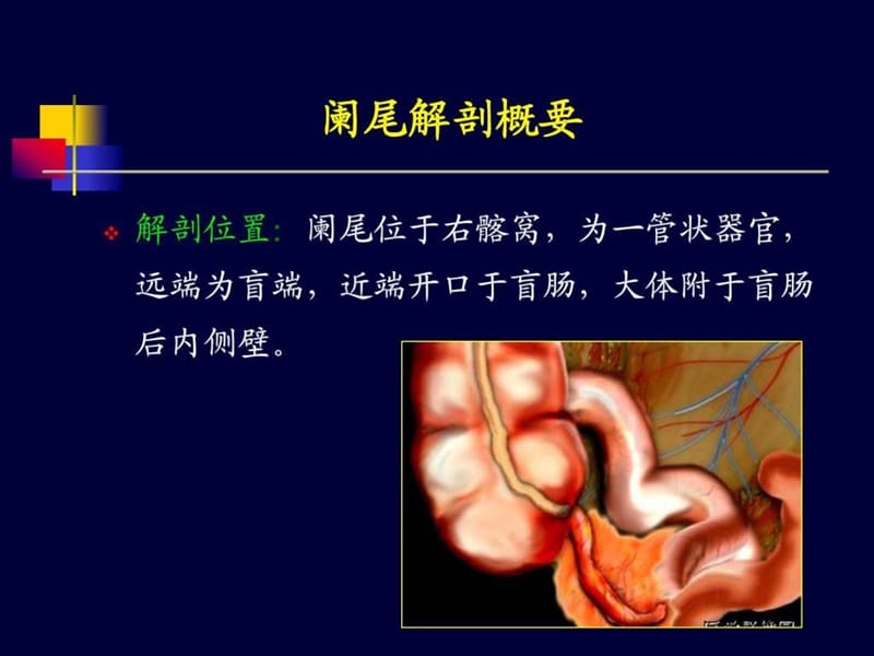 《阑尾炎超声诊断》PPT课件.ppt_第3页