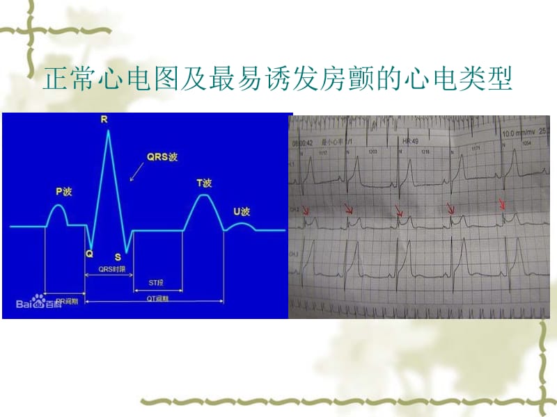 刘思禹除颤仪的使用演示文稿ppt课件.ppt_第3页