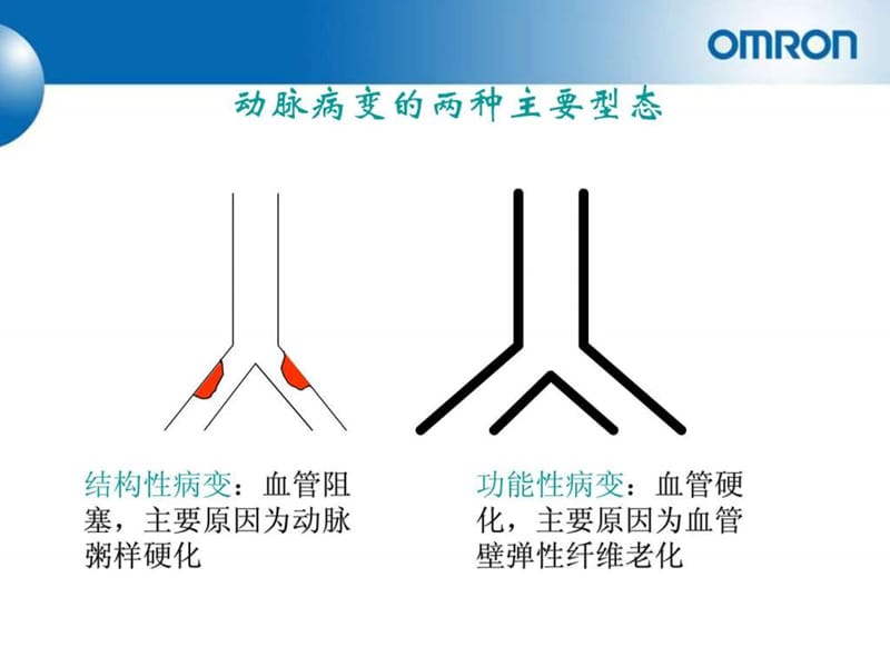 动脉硬化报告解读手册(康华).ppt_第3页