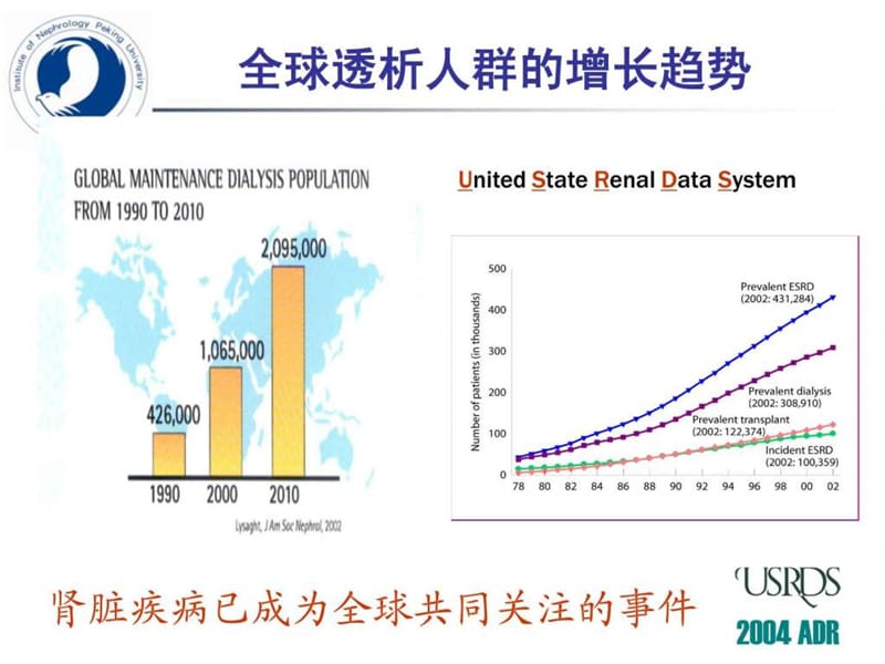 免疫抑制剂在肾脏病中的应用.ppt_第2页