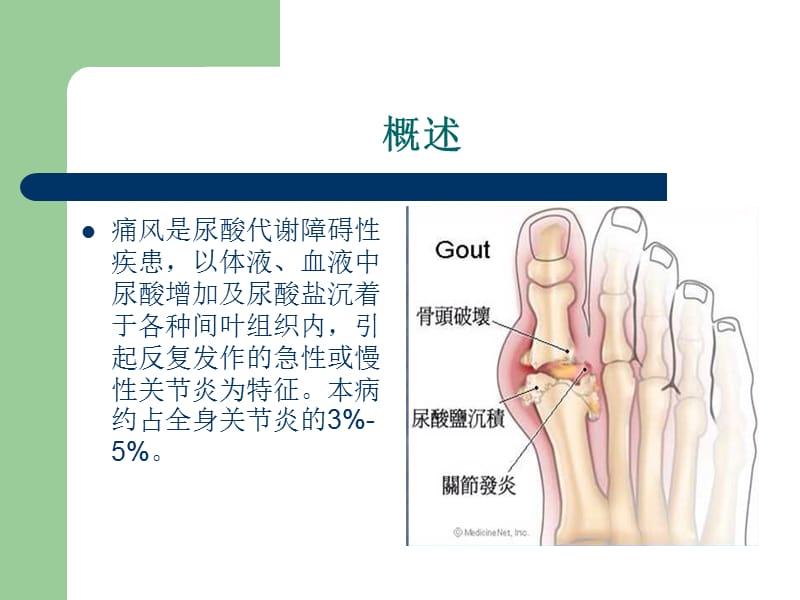 痛风结节的影像表现ppt课件.ppt_第2页