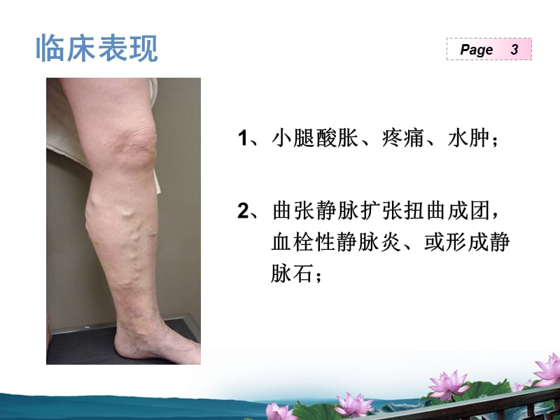 谭最老师泡沫治疗ppt课件.ppt_第3页