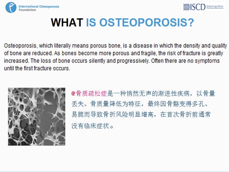 骨质疏松症的临床评价ppt课件.ppt_第2页