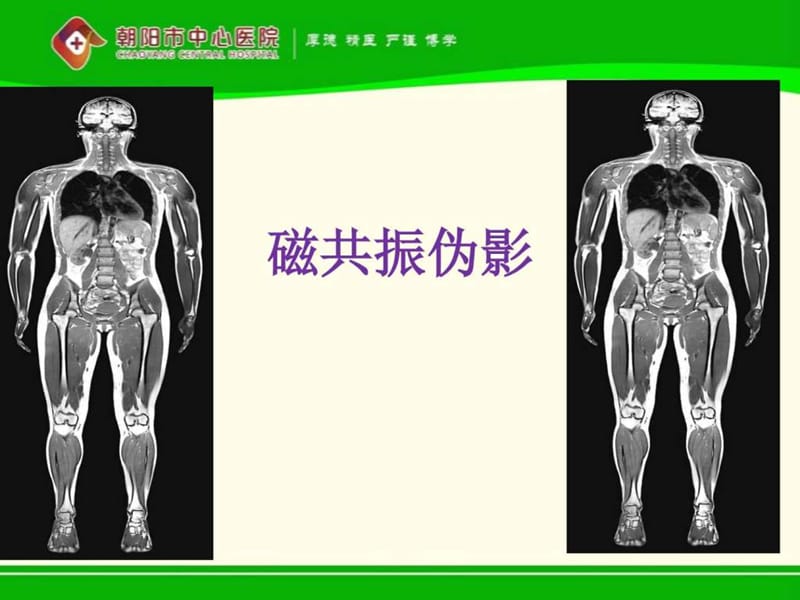 磁共振伪影_临床医学_医药卫生_专业资料.ppt_第1页