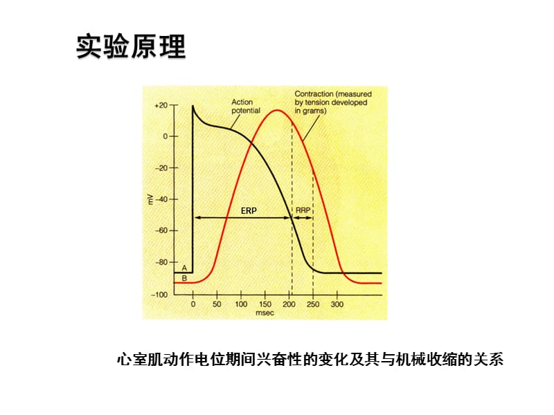 期前收缩和代偿间歇ok.ppt_第3页