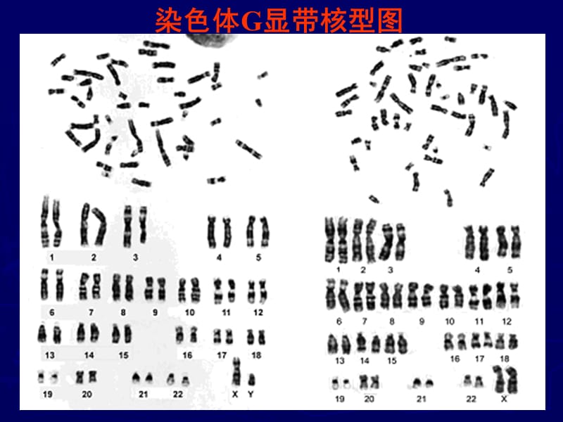 染色体G显带技术及其原理.ppt_第2页