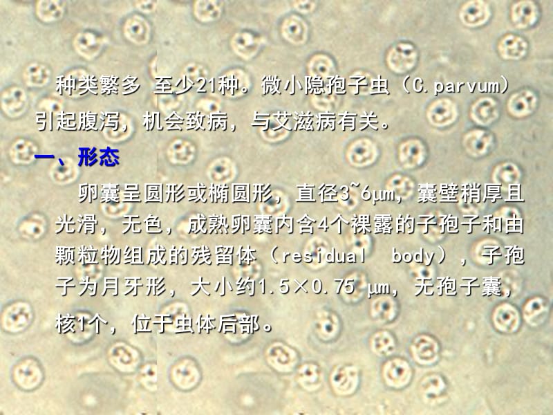 十七节隐孢于虫CryptosporidiumTyzzer1907.ppt_第3页