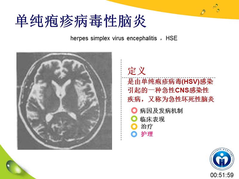 单纯疱疹病毒性脑炎的护理ppt课件.ppt_第3页