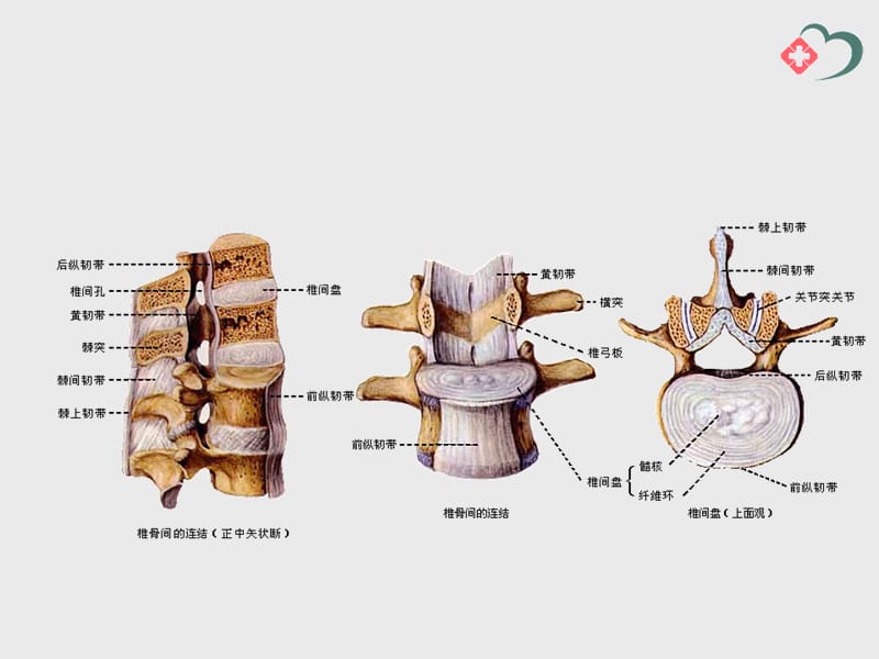 脊柱后关节错位急性腰扭伤髂腰韧带.ppt_第3页