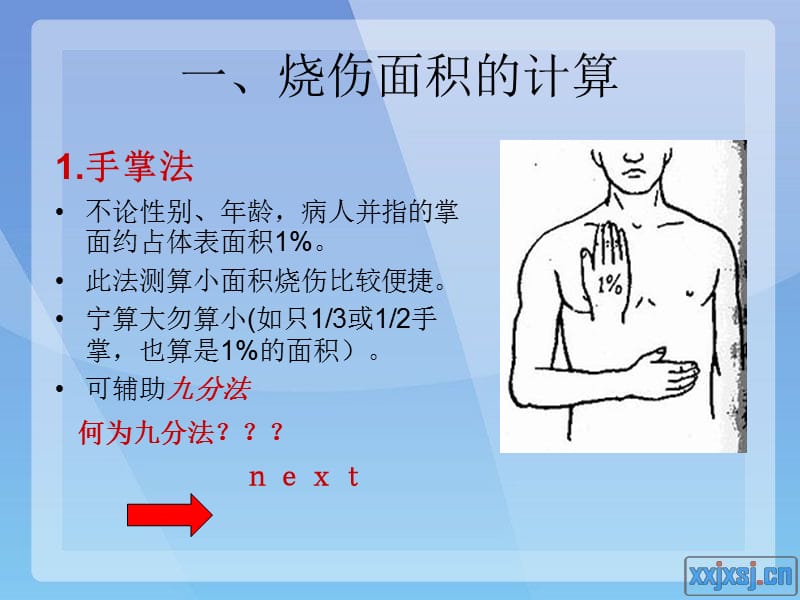 烧伤课件面积.ppt_第2页