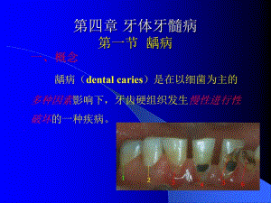 第四章牙体牙髓病.ppt