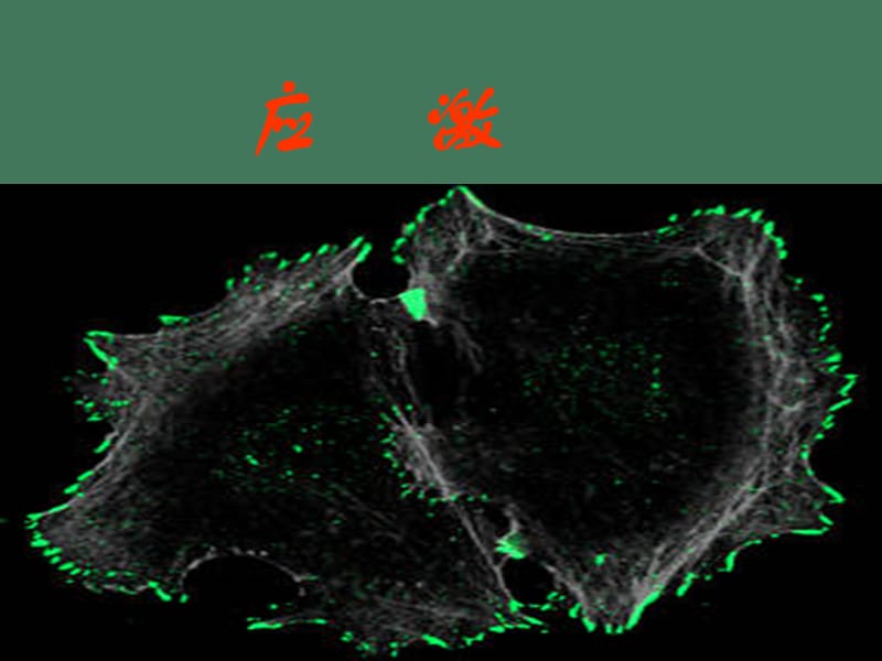 第九章应激DIC.ppt_第1页