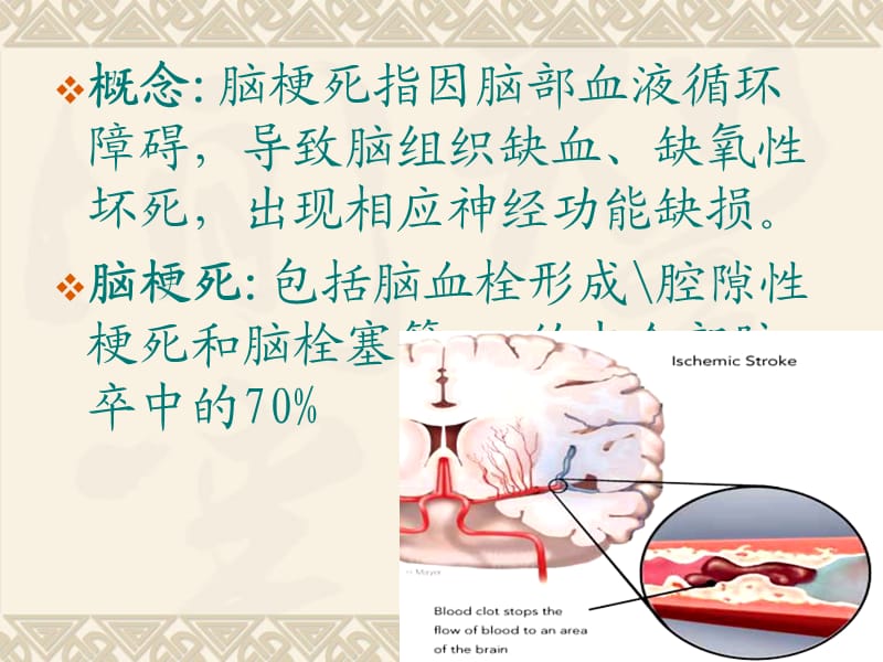 脑梗死诊断、影像学、治疗.ppt_第2页