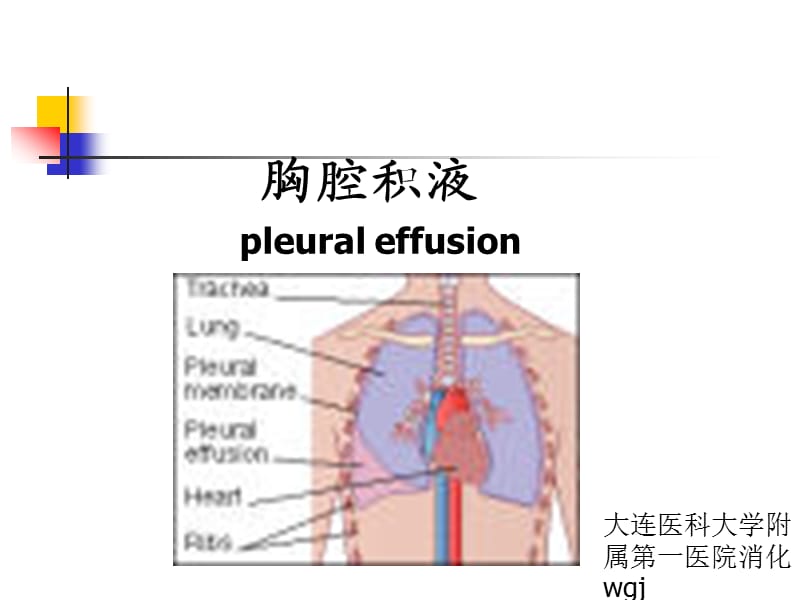 胸腔积液课件.ppt_第1页