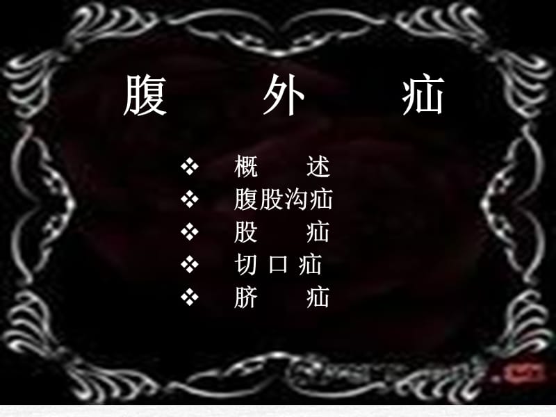 第十八章腹外疝护理.ppt_第2页