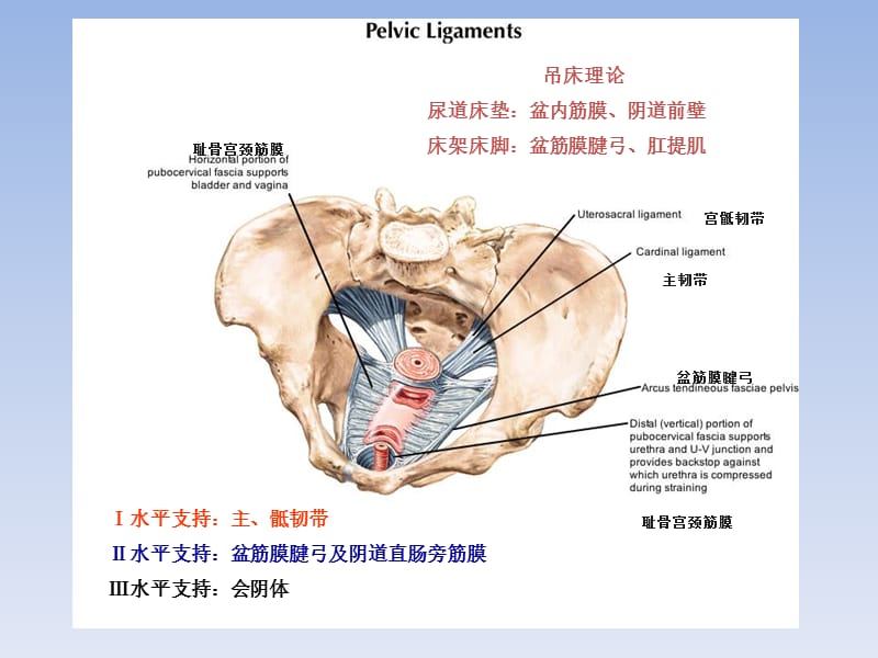 sling手术方式选择的思考.ppt_第2页