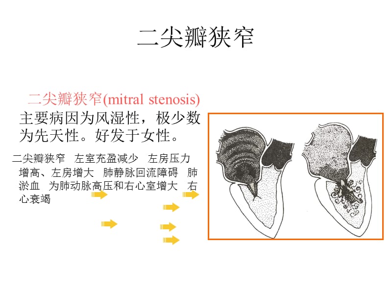 诊断学循环系统常见疾病.ppt_第2页