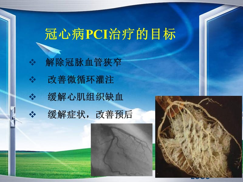 pci围术期心肌保护_陈韵岱.ppt_第2页