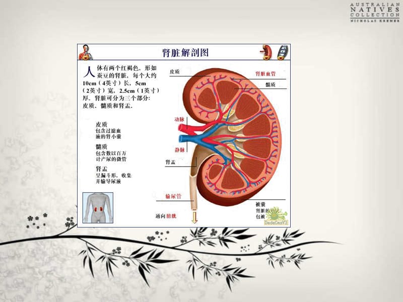 结石围手术期护理.ppt_第2页