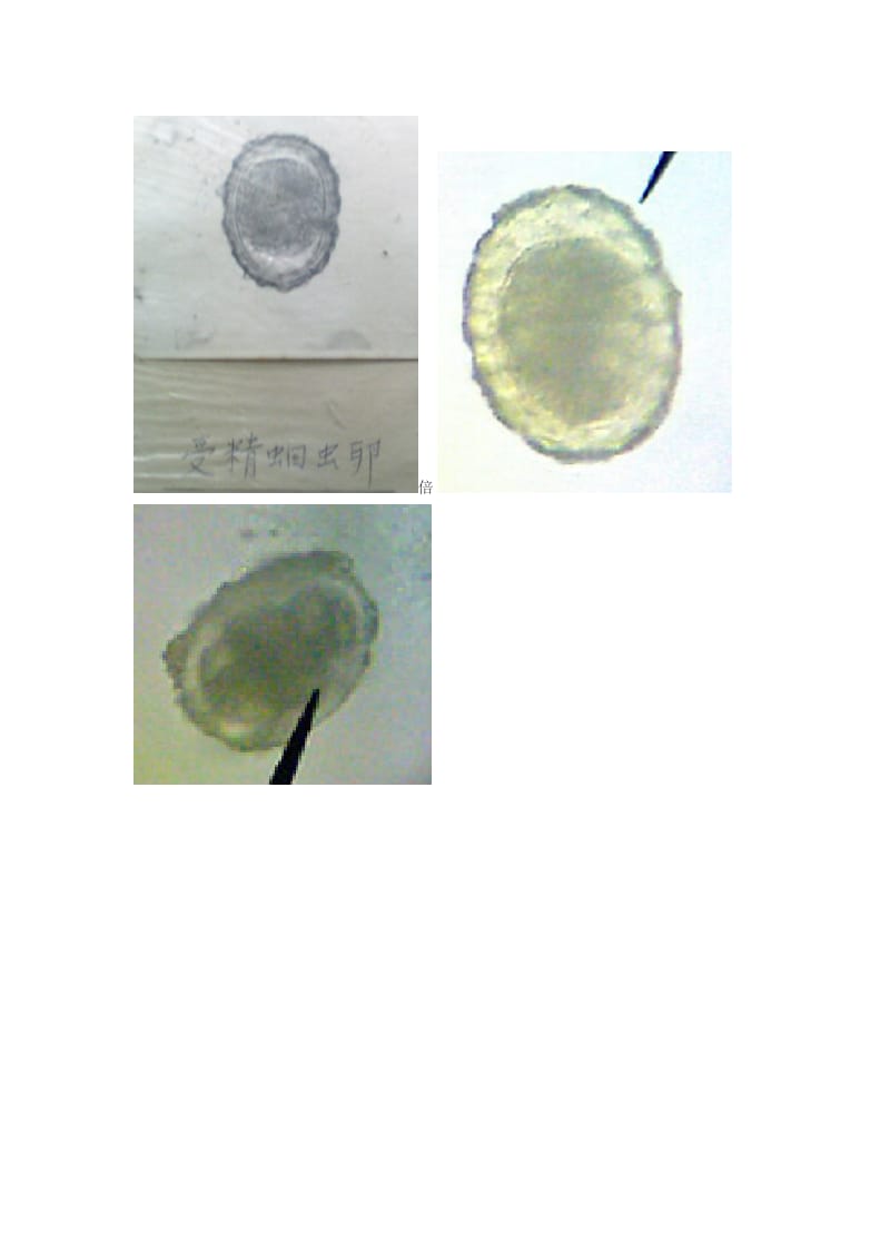 湘雅医学院寄生虫实验标本考试资料寄生虫图谱全切片+标本总结.doc_第2页