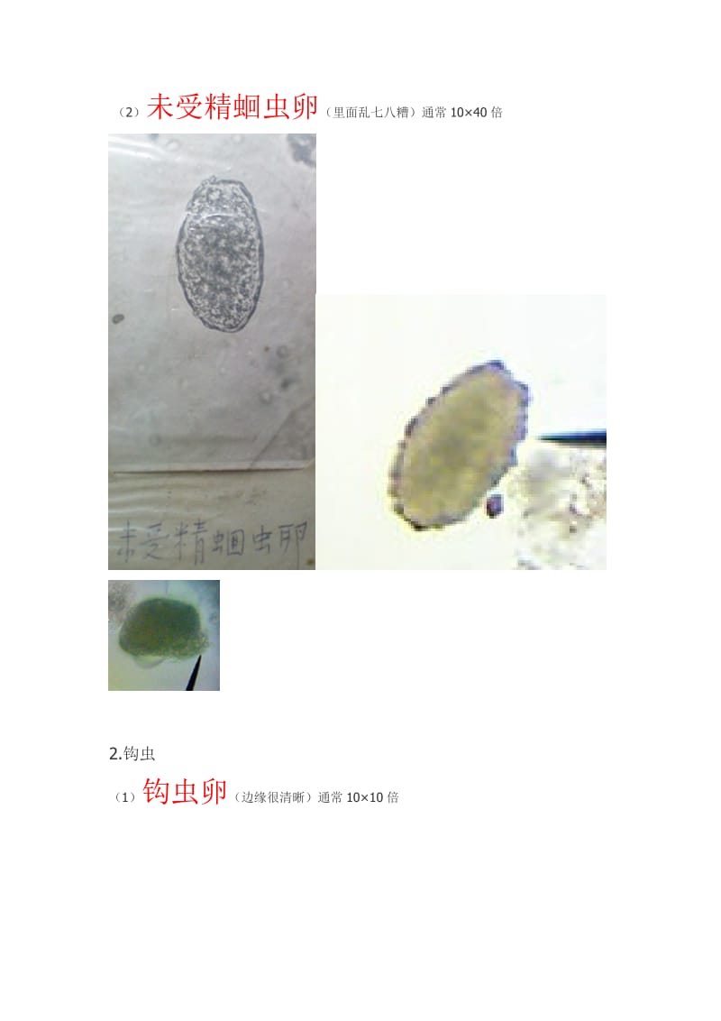 湘雅医学院寄生虫实验标本考试资料寄生虫图谱全切片+标本总结.doc_第3页