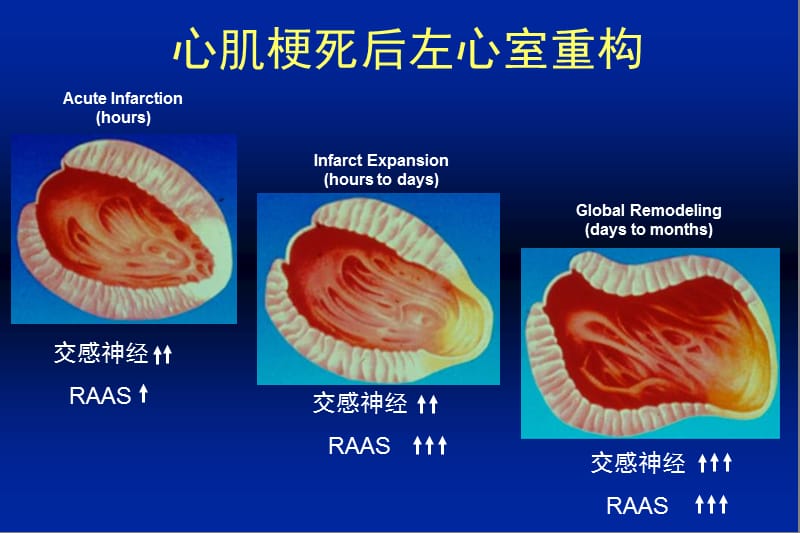 心力衰竭临床药物治疗面临的挑战-会议课件，教学幻灯，PPT.ppt_第3页