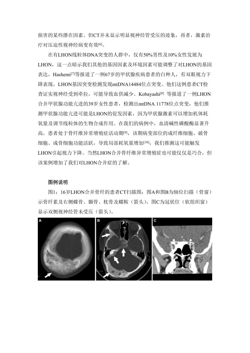 Leber遗传性视神经病变合并骨纤维异常增殖症一例报告(中文版).doc_第3页