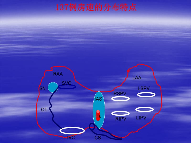 特殊部位房速的标测与消融.ppt_第2页