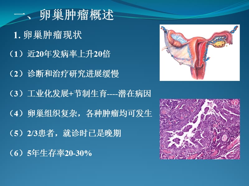 卵巢交界性肿瘤诊治进展.ppt_第3页