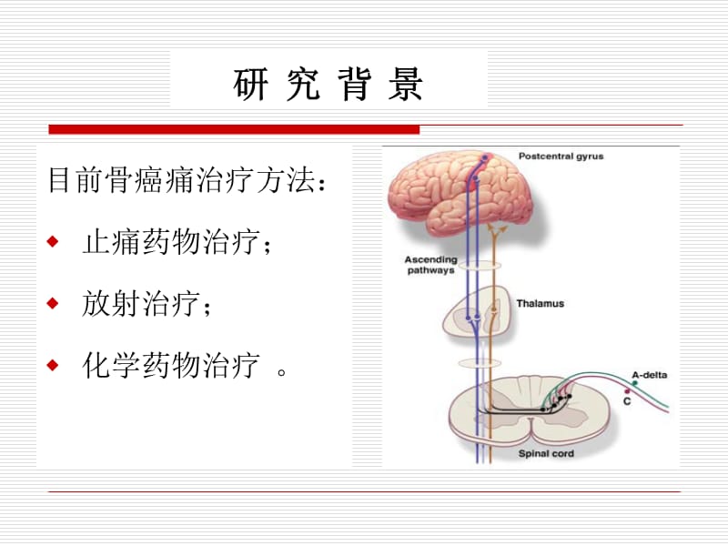 脊髓胶质细胞及前炎性细胞因子在骨癌痛中的作用及机制.ppt_第3页