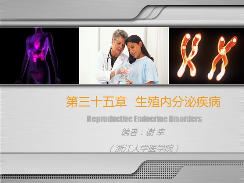 生殖内分泌疾病ppt课件.ppt_第2页