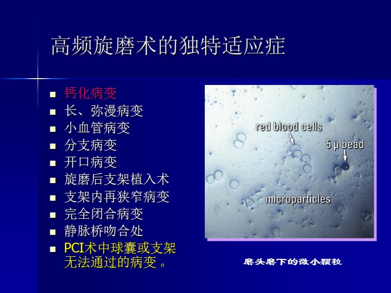 旋磨技术的原理和监护常规.ppt_第3页