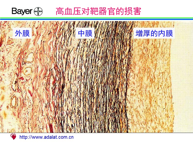 高血压对靶器官的损害（图谱）.ppt_第2页