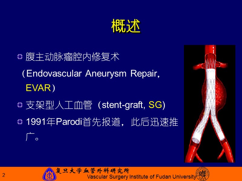 腹主动脉瘤腔内治疗进展.ppt_第2页