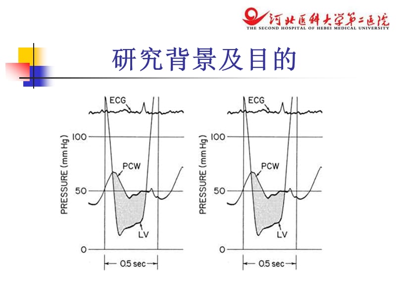 二尖瓣跨瓣压差测量方法的评价及临床应用.ppt_第3页