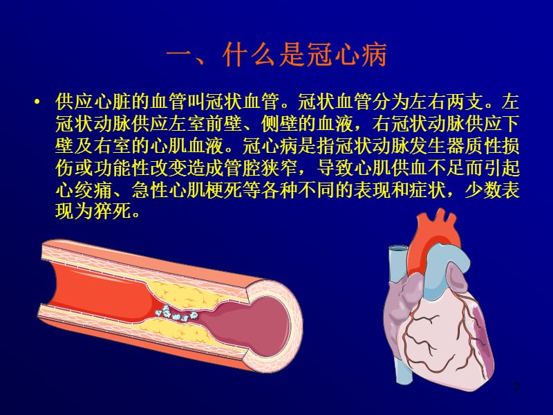 怎样战胜冠心病.ppt_第2页