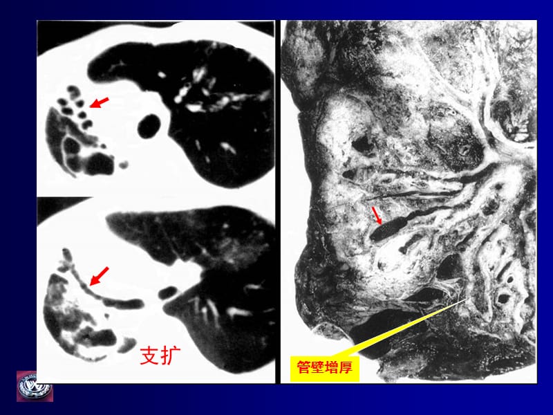 呼吸系统影像诊断.ppt_第2页