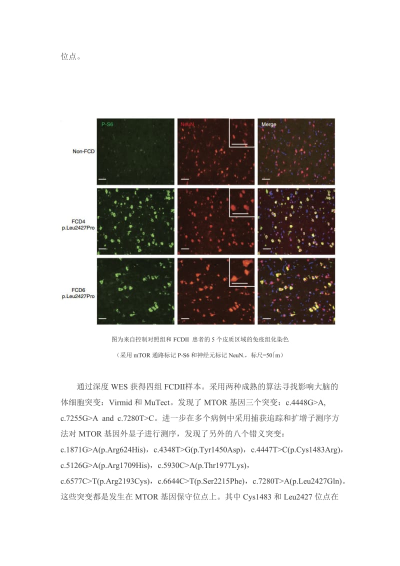 6、大脑体细胞MTOR基因突变引起FCDⅡ,导致顽固性癫痫发生.doc_第3页