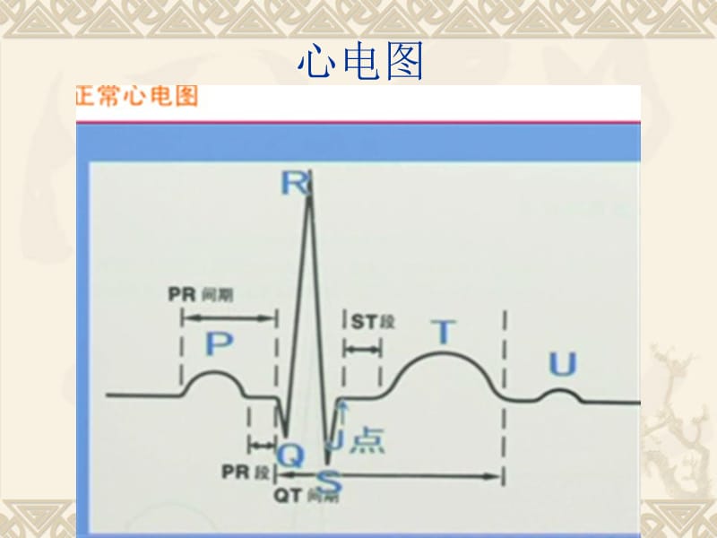 临床实践技能考试-心电图(新改)-2009.ppt_第2页