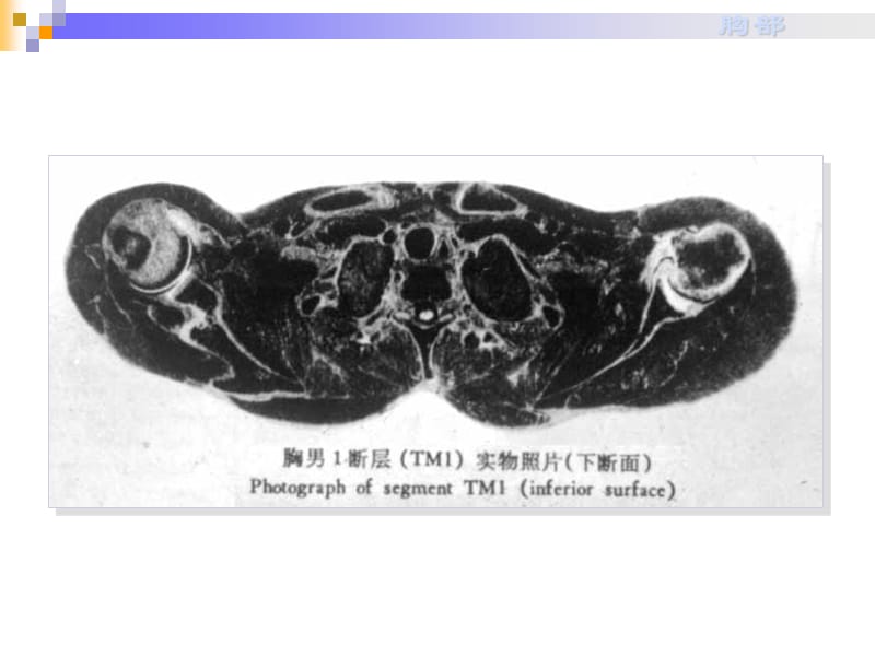 胸部断层解剖课件.ppt_第3页