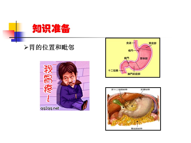 级溃疡病及并发症.ppt_第2页